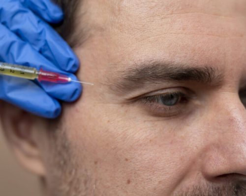 Botox é só para mulheres? Entenda como o procedimento vem conquistando os homens e quais são as diferenças
