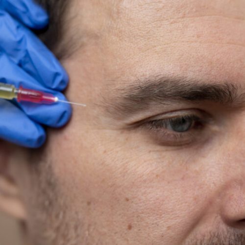 Botox é só para mulheres? Entenda como o procedimento vem conquistando os homens e quais são as diferenças