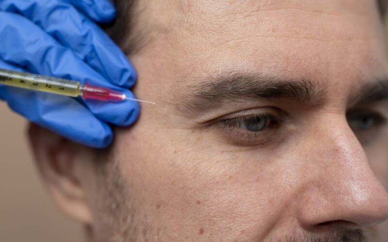 Botox é só para mulheres? Entenda como o procedimento vem conquistando os homens e quais são as diferenças