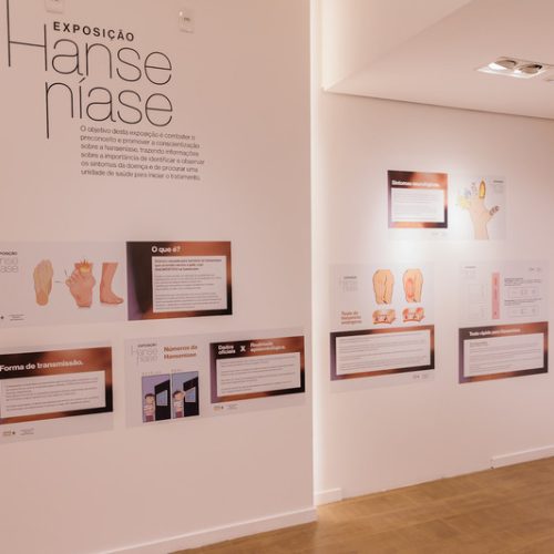 Exposição no RibeirãoShopping alerta para a conscientização da hanseníase