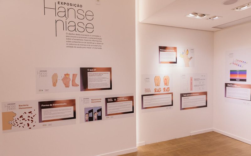 Exposição no RibeirãoShopping alerta para a conscientização da hanseníase