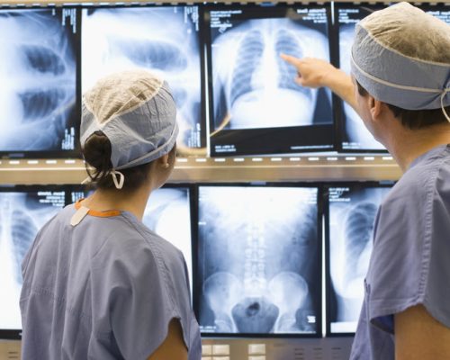 Two medical professionals review charts to a patients lungs.  brandcentralphotos