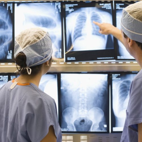 Two medical professionals review charts to a patients lungs.  brandcentralphotos