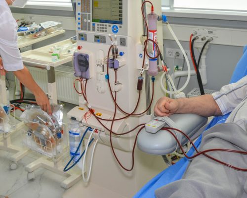 hemodialysis and nephrology, a medical ward for hemodialysis