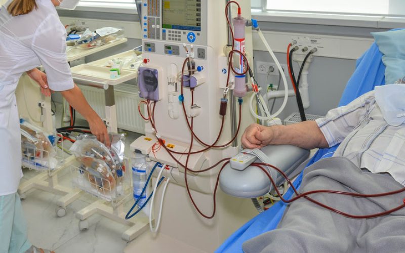 hemodialysis and nephrology, a medical ward for hemodialysis